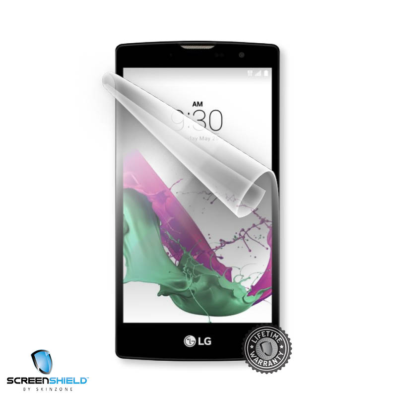 Screenshield™ LG H525 G4c